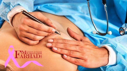 ماموپلاستی یا جراحی زیبایی پستان