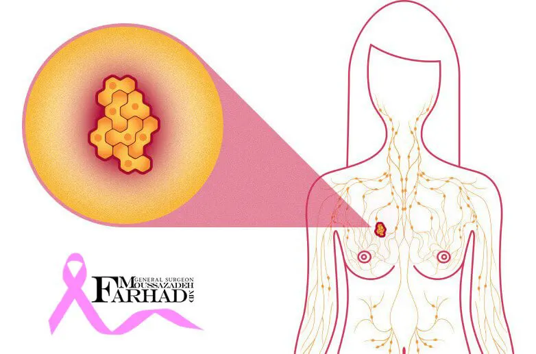 Methods-of-diagnosing-breast-discharge-1