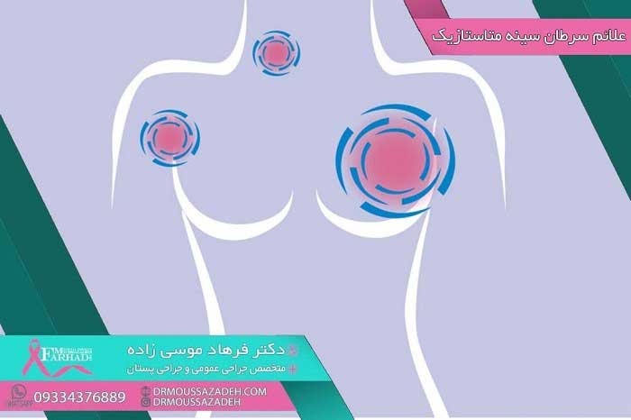علائم-سرطان-پستان-متاستاتیک