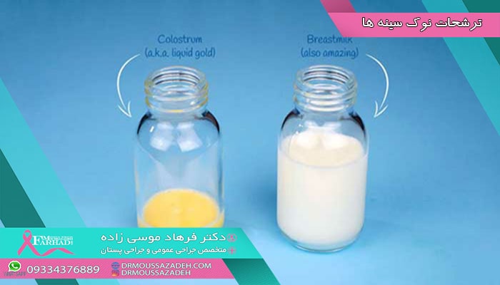 ترشحات نوک سینه ها