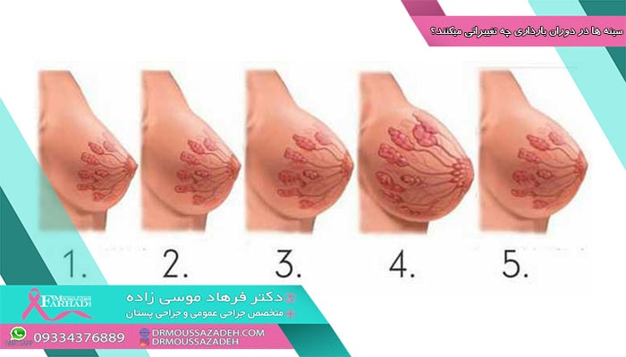 سینه ها در دوران بارداری چه تغییراتی میکنند؟