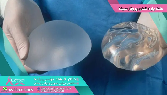 علت_-پاره-شدن-پروتز-سینه-