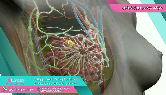 معاینات سینه در دوران بارداری