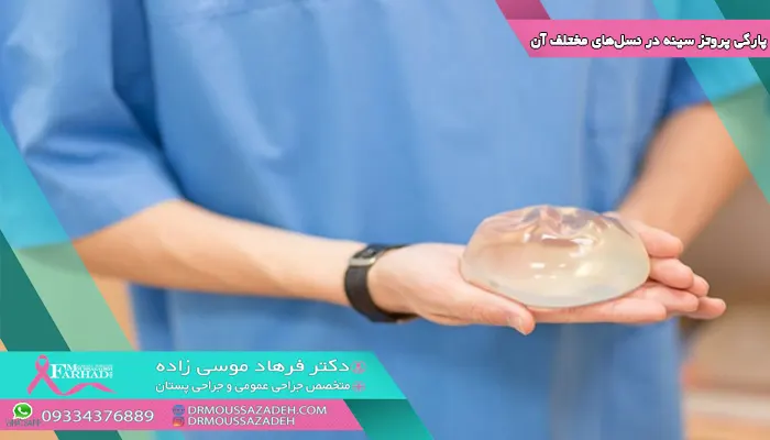 پارگی-پروتز-سینه-در-نسل_های-مختلف-آن-