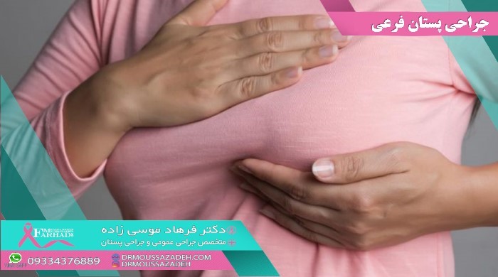 شکل و ظاهر پستان فرعی چطوریه؟