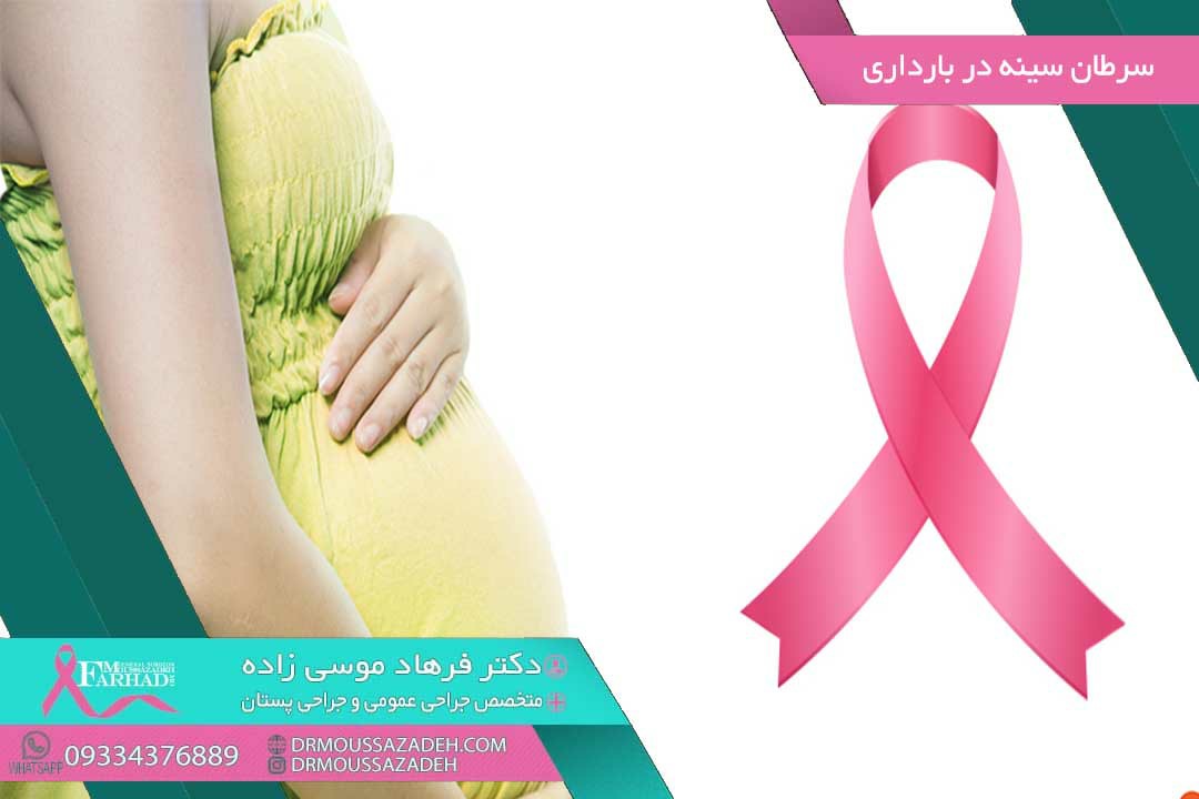 درمان سرطان سینه در بارداری