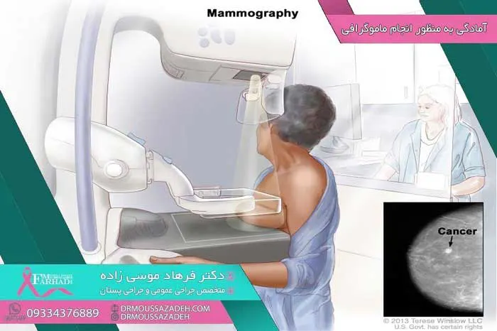 آمادگی-برای-منظور-ماموگرافی