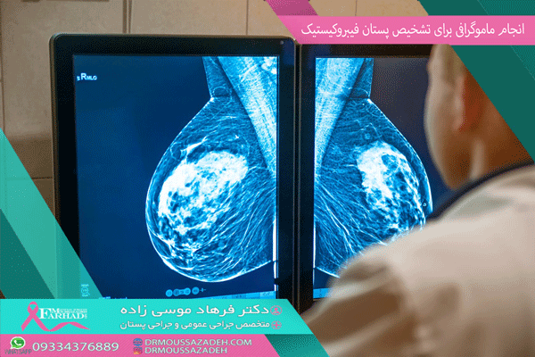 انجام-ماموگرافی-برای-تشخیص-پستان-فیبروکیستیک-