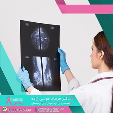 آیا اشعه ماموگرافی خطرناک است