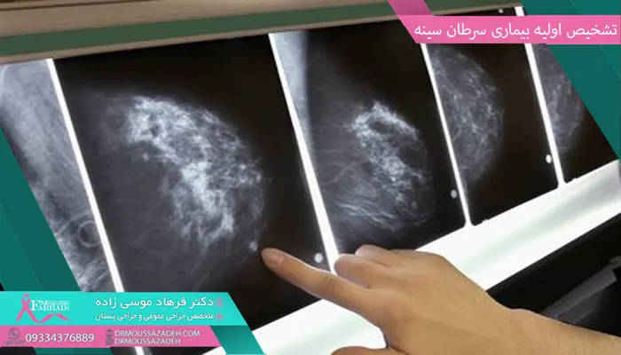 تشخیص اولیه سرطان سینه