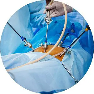 laparoscopic-surgery-cover